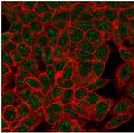 Myogenin/Myf-4 (Skeletal Muscle Marker) (Transcription Factor) Antibody in Immunocytochemistry (ICC/IF)