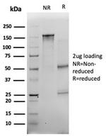 Myogenin/Myf-4 (Skeletal Muscle Marker) (Transcription Factor) Antibody in SDS-PAGE (SDS-PAGE)