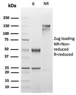 Myogenin/Myf-4 (Skeletal Muscle Marker) Antibody in SDS-PAGE (SDS-PAGE)