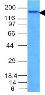 CD56/NCAM1/NKH1 Antibody in Western Blot (WB)