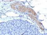 CD56/NCAM1/NKH1 Antibody in Immunohistochemistry (Paraffin) (IHC (P))