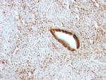 Nucleolin Antibody in Immunohistochemistry (Paraffin) (IHC (P))