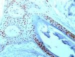 Nucleolin Antibody in Immunohistochemistry (Paraffin) (IHC (P))