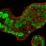 Nucleolin (Marker of Human Cells) Antibody in Immunocytochemistry (ICC/IF)