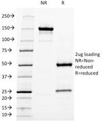 Neurofilament (NF-H) (Neuronal Marker) Antibody in SDS-PAGE (SDS-PAGE)