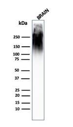 Neurofilament (NF-H) (Neuronal Marker) Antibody in Western Blot (WB)