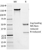 Phospho-NF-H Antibody in SDS-PAGE (SDS-PAGE)