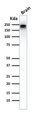 Phospho-NF-H Antibody in Western Blot (WB)