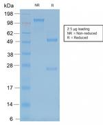 Neurofilament Antibody in SDS-PAGE (SDS-PAGE)