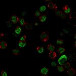 Neurofilament (NF-L) (Neuronal Marker) Antibody in Immunocytochemistry (ICC/IF)