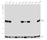 PGP9.5 Antibody in Western Blot (WB)