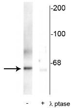 Phospho-PLK1 (Thr210) Antibody in Western Blot (WB)