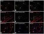 CD3 Antibody in Immunohistochemistry (IHC)