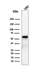 NGF-Receptor (p75)/CD271 Antibody in Western Blot (WB)