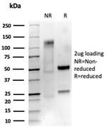 NGF-Receptor (p75)/CD271 (Soft Tissue Tumor Marker) Antibody in SDS-PAGE (SDS-PAGE)