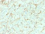 NGF-Receptor (p75)/CD271 Antibody in Immunohistochemistry (Paraffin) (IHC (P))