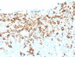 NGF-Receptor (p75)/CD271 Antibody in Immunohistochemistry (Paraffin) (IHC (P))