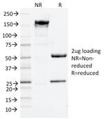 NGF-Receptor (p75)/CD271 Antibody in SDS-PAGE (SDS-PAGE)