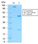 NGF-Receptor (p75)/CD271 Antibody in SDS-PAGE (SDS-PAGE)