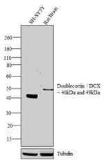 Doublecortin Antibody in Western Blot (WB)