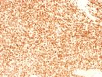 NKX2.2 (Neuroendocrine and Ewing's Sarcoma Marker) Antibody in Immunohistochemistry (Paraffin) (IHC (P))