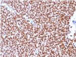 NKX2.2 Antibody in Immunohistochemistry (Paraffin) (IHC (P))