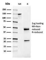 NKX3.1 (Metastatic Prostate Adenocarcinoma Marker) Antibody in SDS-PAGE (SDS-PAGE)