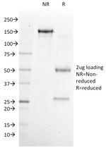 NKX6.1 (Marker for Pancreatic and Duodenal Neuroendocrine Tumors) Antibody in SDS-PAGE (SDS-PAGE)