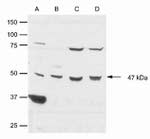 CK1 epsilon Antibody in Western Blot (WB)