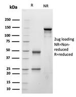 Natriuretic Peptide B/NPPB Antibody in SDS-PAGE (SDS-PAGE)