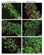 Pannexin 1 Antibody in Immunohistochemistry (Frozen) (IHC (F))