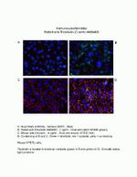 MARVELD2 Antibody in Immunocytochemistry (ICC/IF)