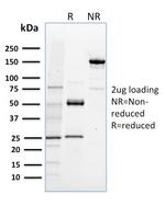 NRF1 Antibody in SDS-PAGE (SDS-PAGE)