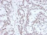 NRF1 Antibody in Immunohistochemistry (Paraffin) (IHC (P))