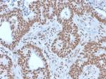 NRF1 Antibody in Immunohistochemistry (Paraffin) (IHC (P))