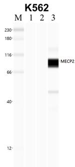 MECP2 Antibody in RNA Immunoprecipitation (RIP)