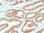 YBX1/Y-box Binding Protein 1/YB-1 Antibody in Immunohistochemistry (Paraffin) (IHC (P))