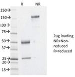 YBX1/Y-box Binding Protein 1/YB-1 Antibody in SDS-PAGE (SDS-PAGE)