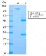YBX1/Y-box Binding Protein 1/YB-1 (Tumor Biomarker) Antibody in SDS-PAGE (SDS-PAGE)