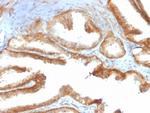 YBX1/Y-box Binding Protein 1/YB-1 (Tumor Biomarker) Antibody in Immunohistochemistry (Paraffin) (IHC (P))