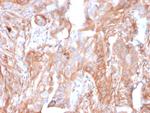 CD73 (Immuno-Oncology Target) Antibody in Immunohistochemistry (Paraffin) (IHC (P))