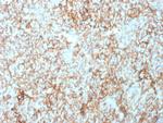 CD73 (Immuno-Oncology Target) Antibody in Immunohistochemistry (Paraffin) (IHC (P))