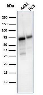 CD73 (Immuno-Oncology Target) Antibody in Western Blot (WB)
