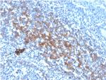 CD73 (Immuno-Oncology Target) Antibody in Immunohistochemistry (Paraffin) (IHC (P))