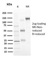 CD73 (Immuno-Oncology Target) Antibody in SDS-PAGE (SDS-PAGE)