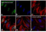 H3K9ac Antibody in Immunocytochemistry (ICC/IF)