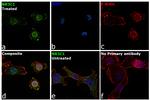 Glucocorticoid Receptor Antibody in Immunocytochemistry (ICC/IF)