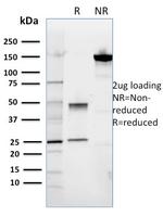 ROR2 Antibody in SDS-PAGE (SDS-PAGE)