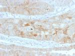 ROR2 Antibody in Immunohistochemistry (Paraffin) (IHC (P))