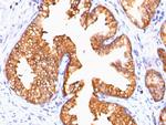 Ornithine Decarboxylase-1 (ODC-1) Antibody in Immunohistochemistry (Paraffin) (IHC (P))